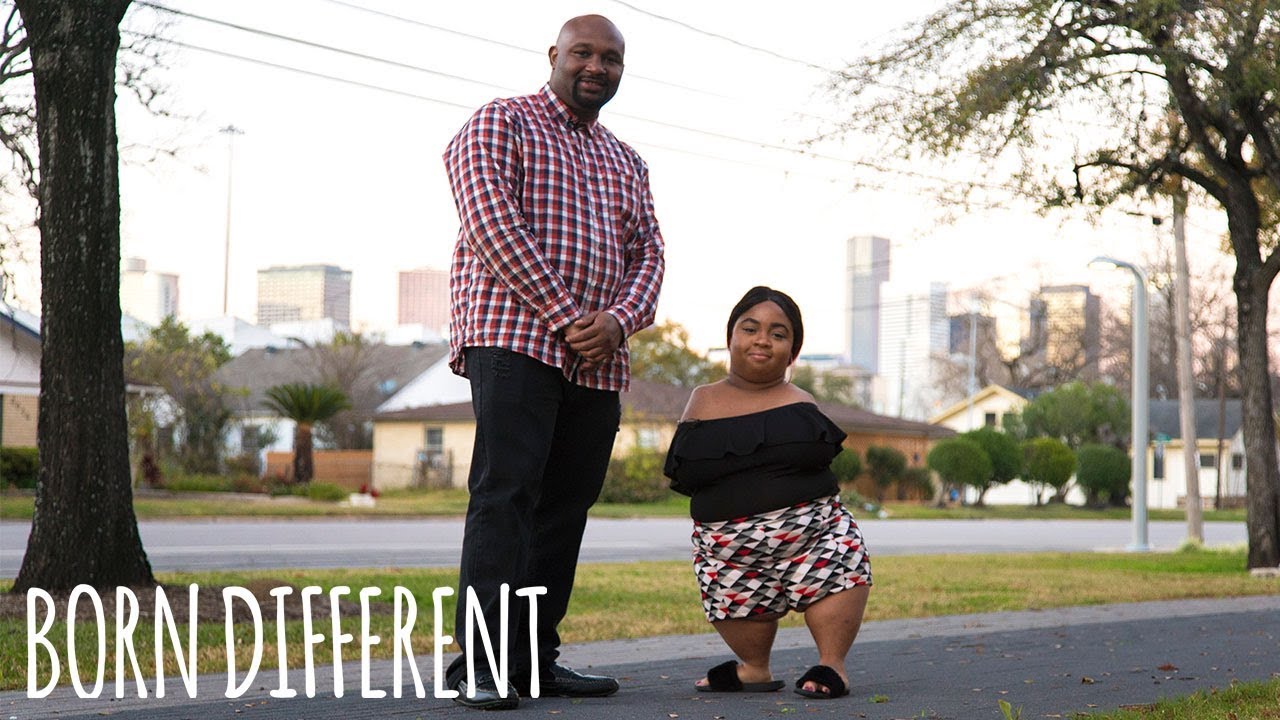 Woman born without arms, and knees finds love