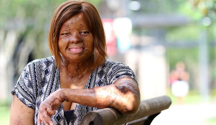 Sosoliso Crash Survivor, Kechi Okwuchi, Celebrates 30th Birthday In Grand Style