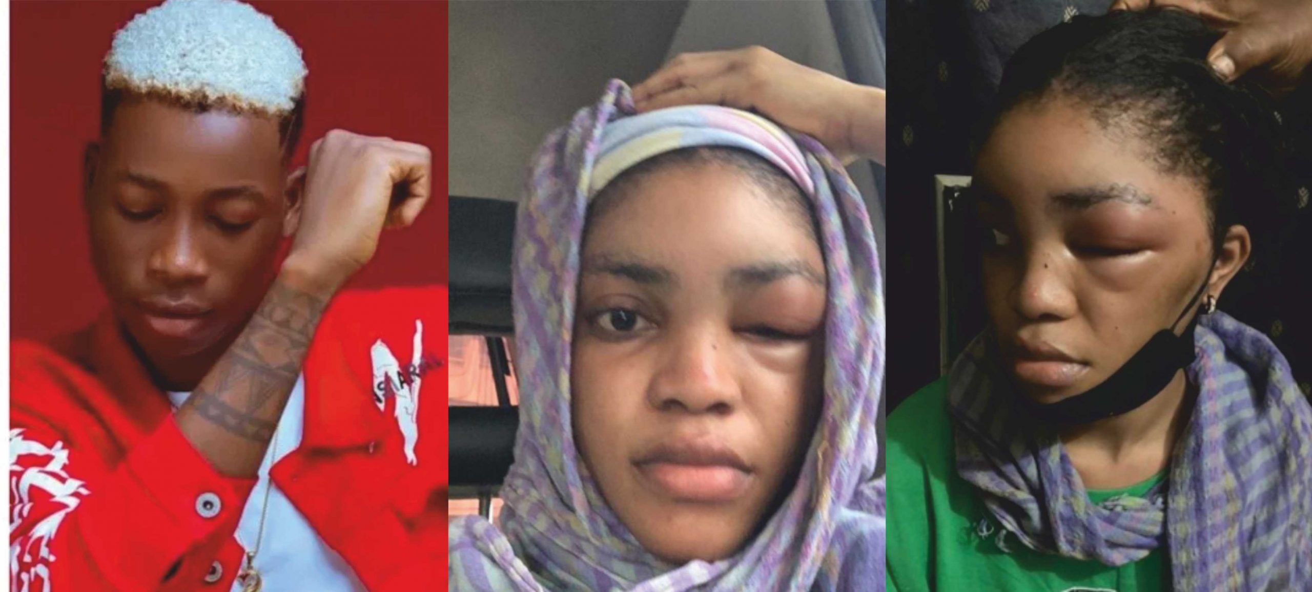 Lil Frosh Reacts to Girlfriend’s Assault Claim
