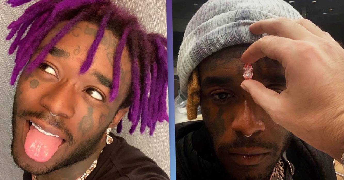 Lil Uzi Vert Implants $24m Pink Diamond on His Forehead