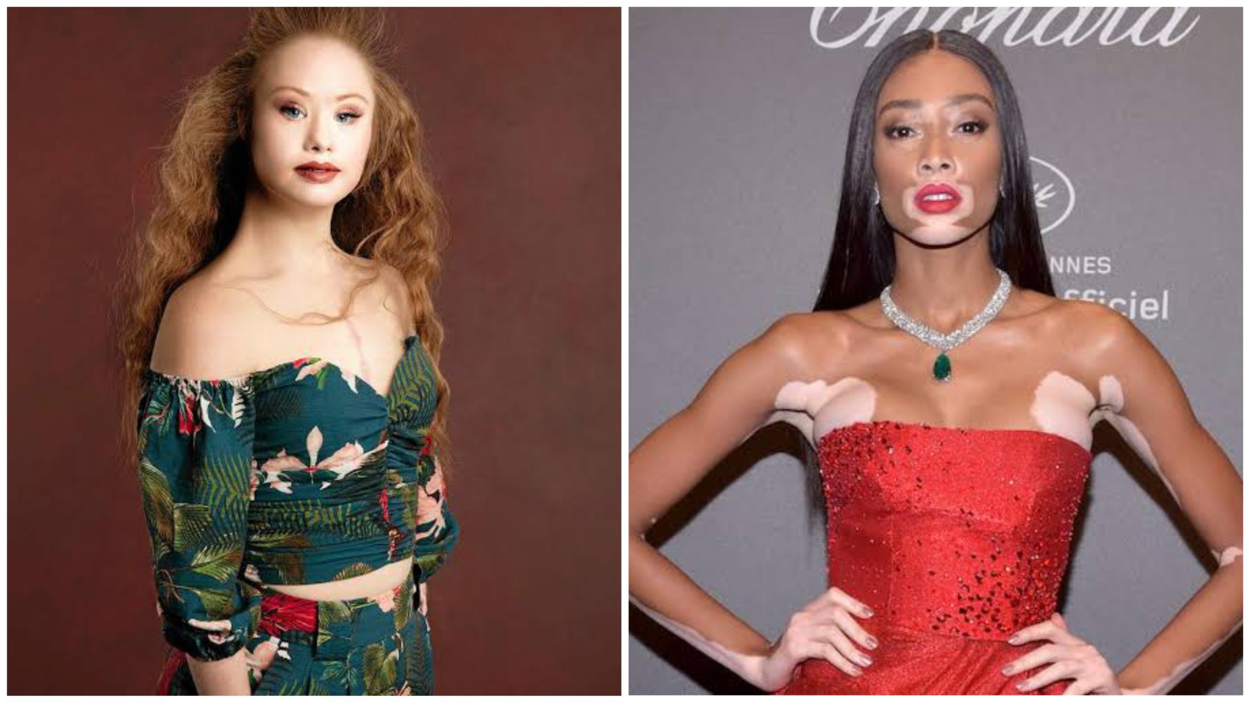 5 Models That Broke Fashion Industry Standards