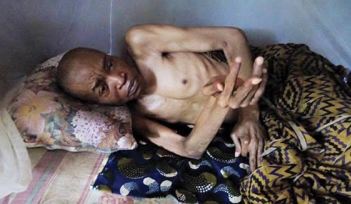 Nigerian actor on sickbed for 20 years seeks financial assistance