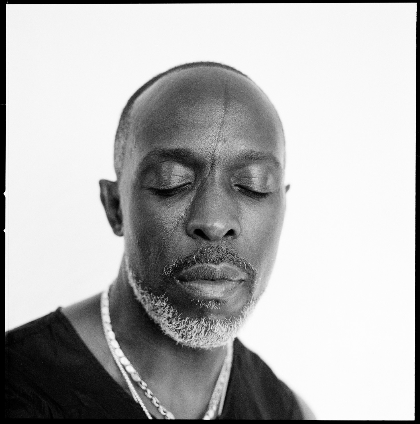 Michael K Williams: The story behind the scar