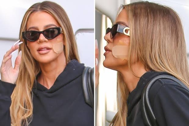 Khloe Kardashian undergoes surgery to remove tumor from her face