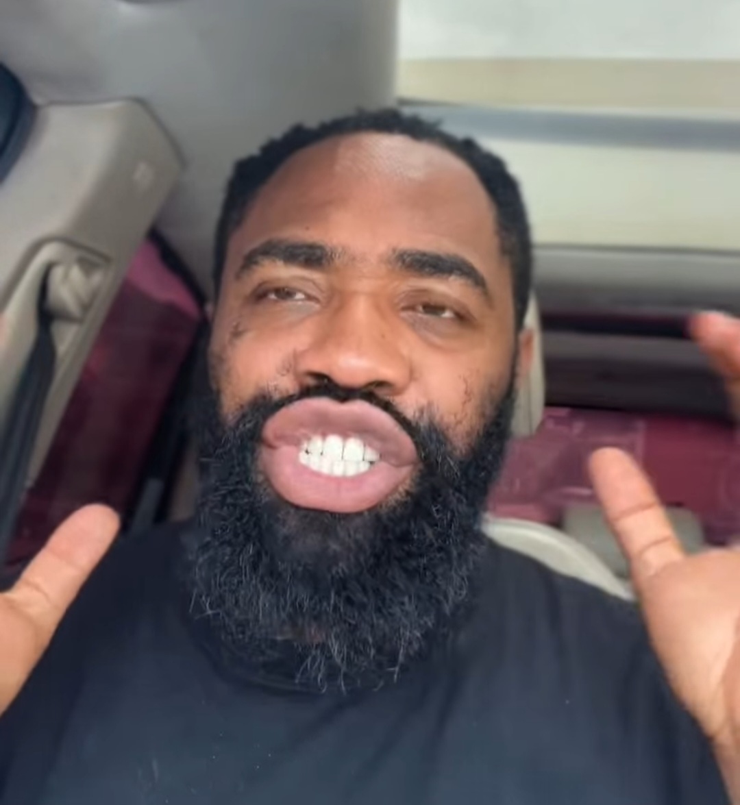 Woli Arole slams content creators over offensive ‘Imbe Challenge’ mocking children with Down Syndrome