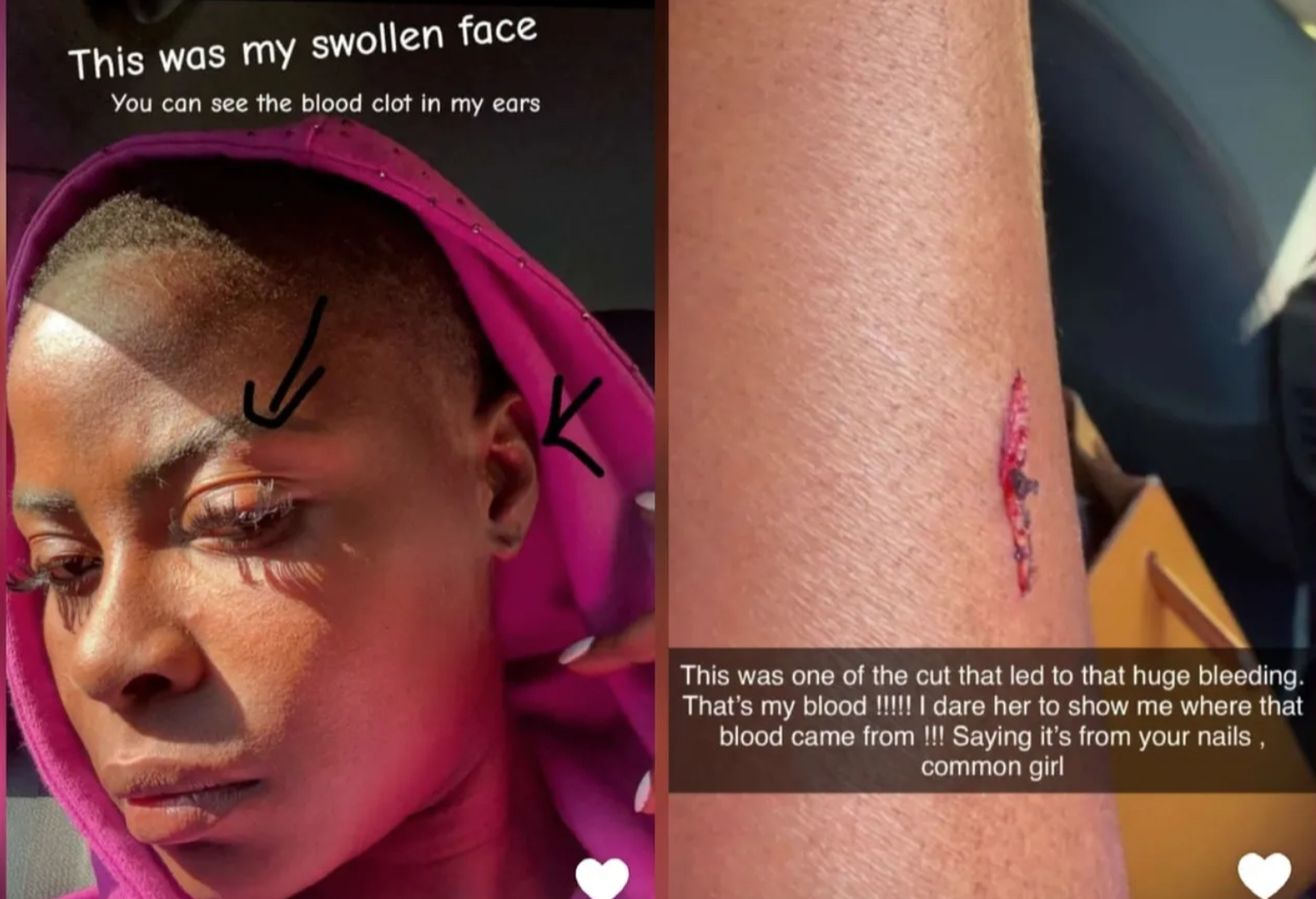 BBNaija star, Khloe speaks after being beaten, humiliated in Italy