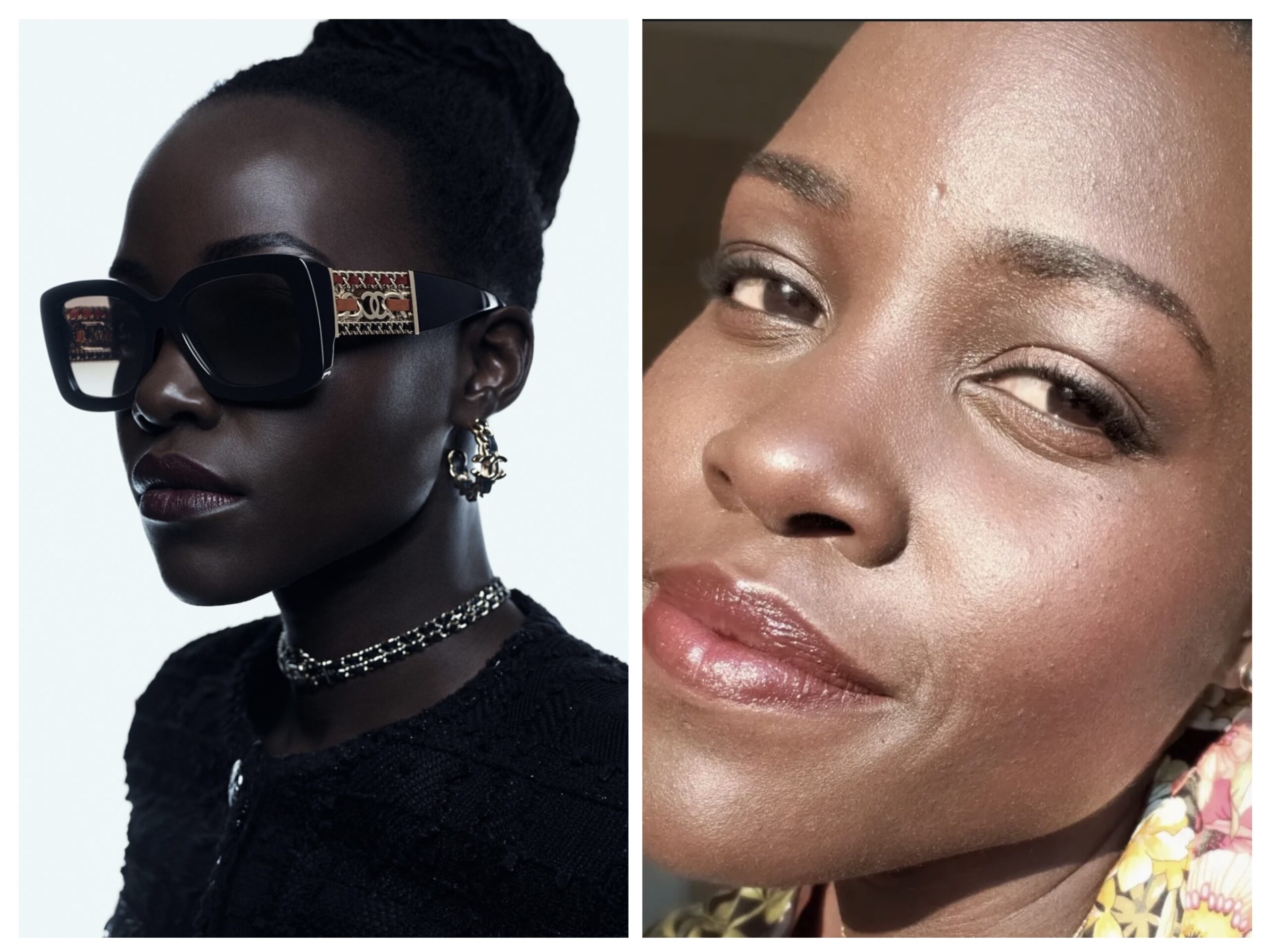 Lupita Nyongo calls for more research on fibroids?
