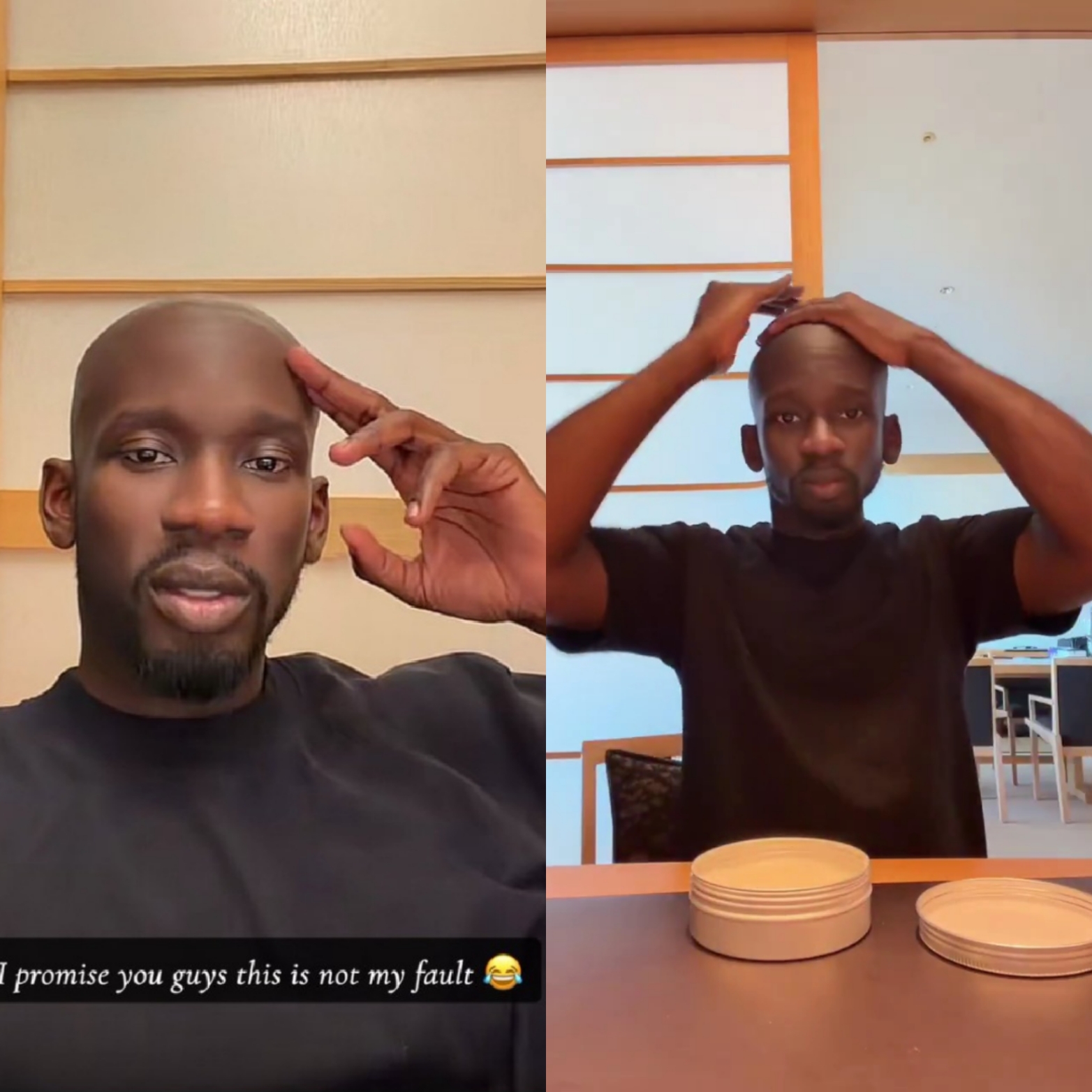 Mr Eazi Joins Elongating List of Bald Musicians, Netizens React