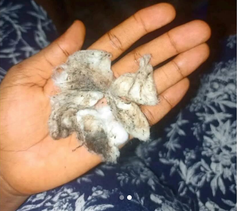 Nigerian Lady Shares What Came Out Of Her Nipple After Cleaning Them [Photo]