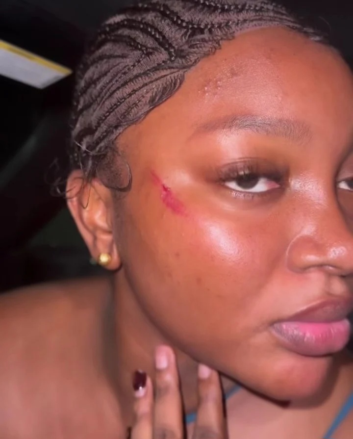 Papaya Ex Alleges Assault by Police Officer in Lagos, Sparks Outrage Online