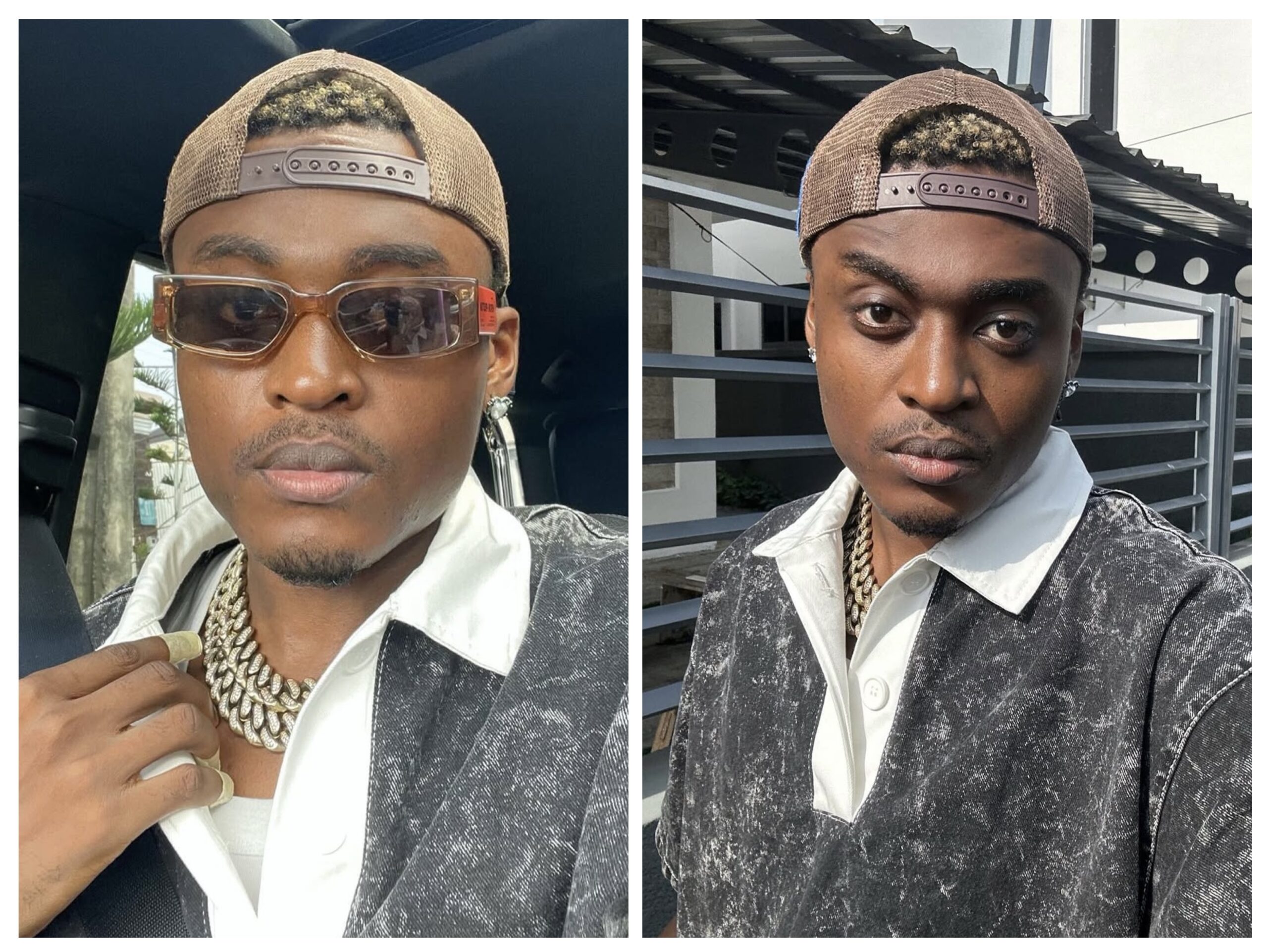 How Acne Almost Made me Quit Music- Superboy Cheque