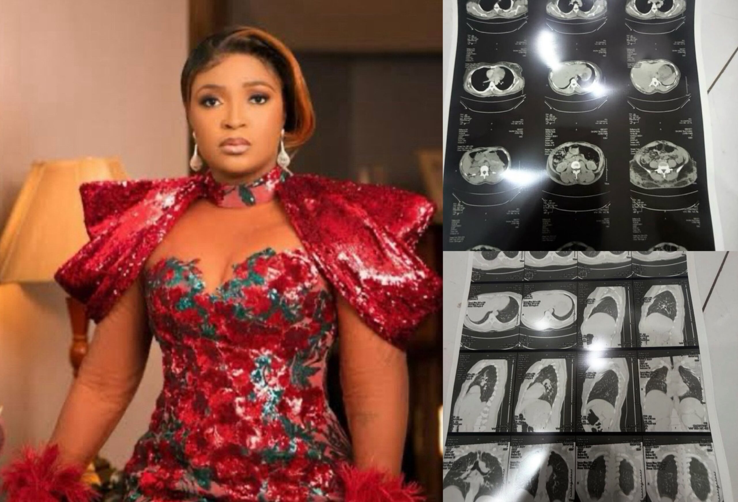 Blessing CEO Releases Medical Reports and CT Scans Publicly Amid Cancer Controversy, Urges Doctors to Verify
