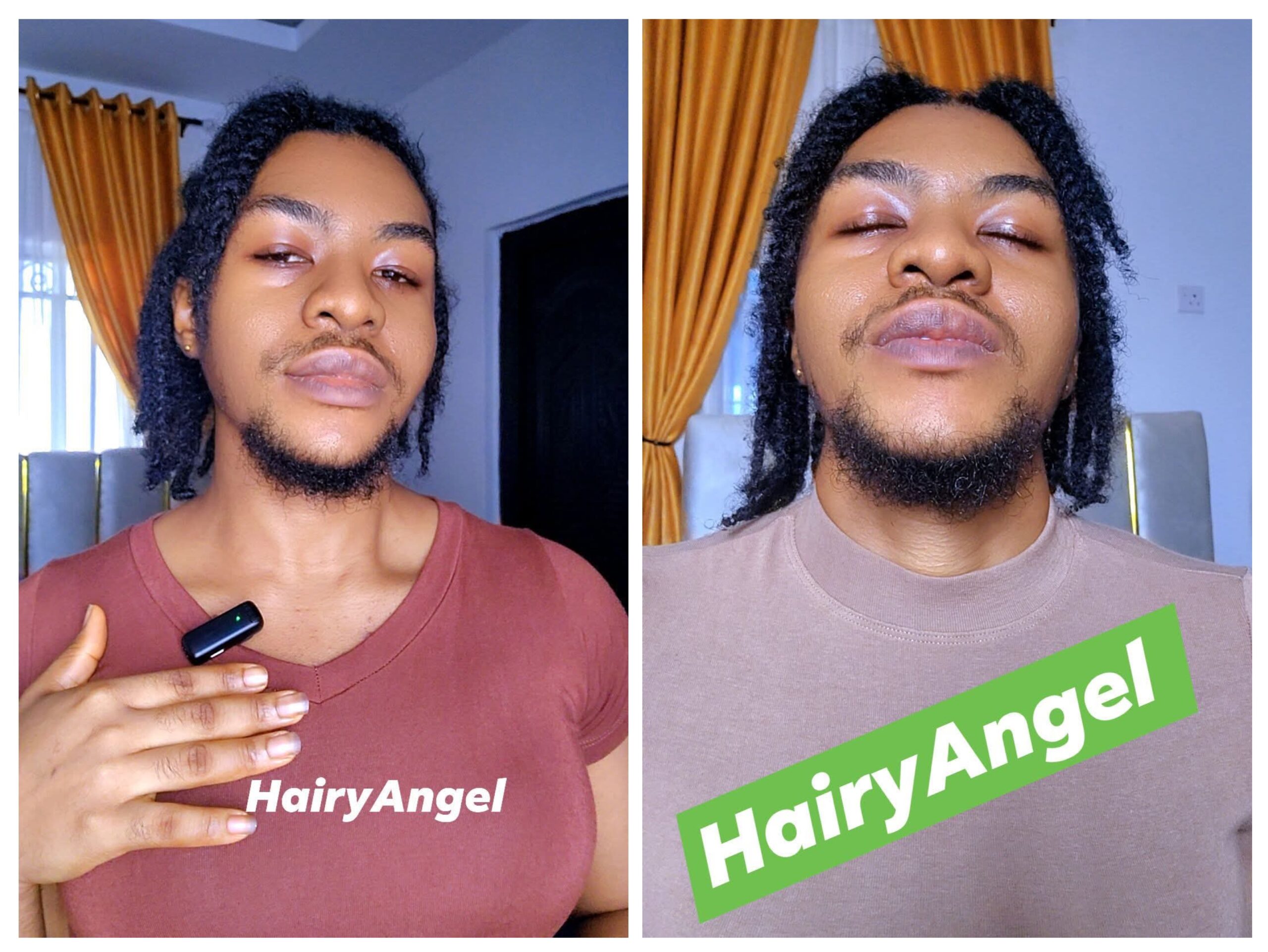 Hairy Angel: Story of Nigerian Woman Suffering Rejection for Having Beards