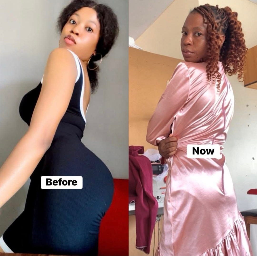 Breastfeeding: Nigerian Lady Recounts how Childbirth Changed her Physique