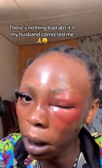 Nigerian Lady Lauds Husband after She was Physically Assaulted by him (VIDEO)