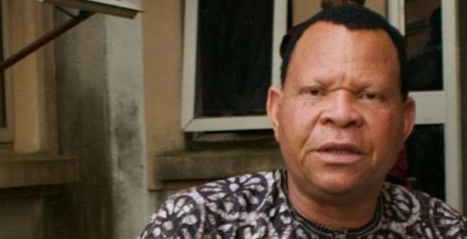 Veteran Nollywood Actor, Elesho Undergoes Major Surgery