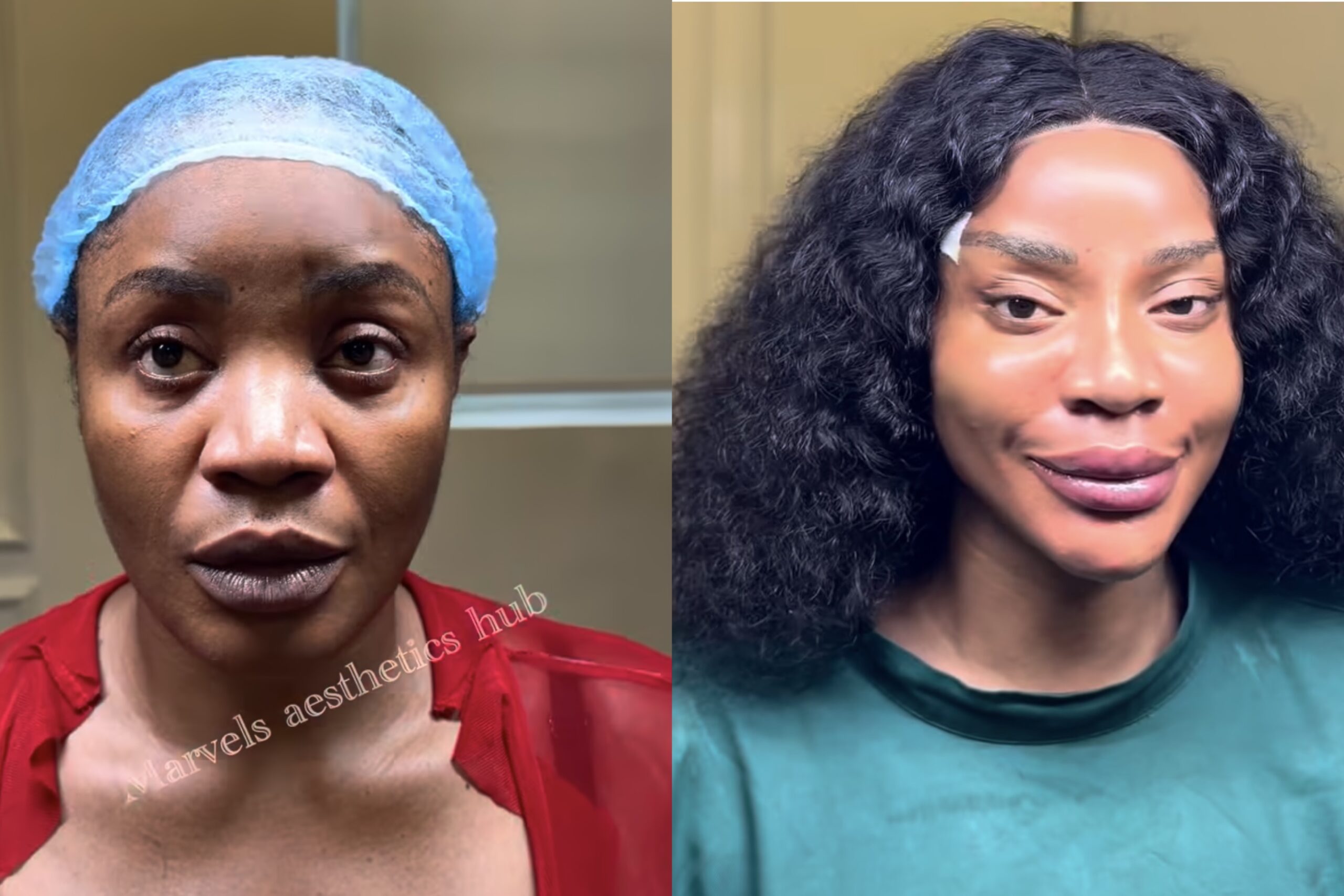 Actress Uche Ogbodo Sparks Mixed Reactions Over ‘New Face’