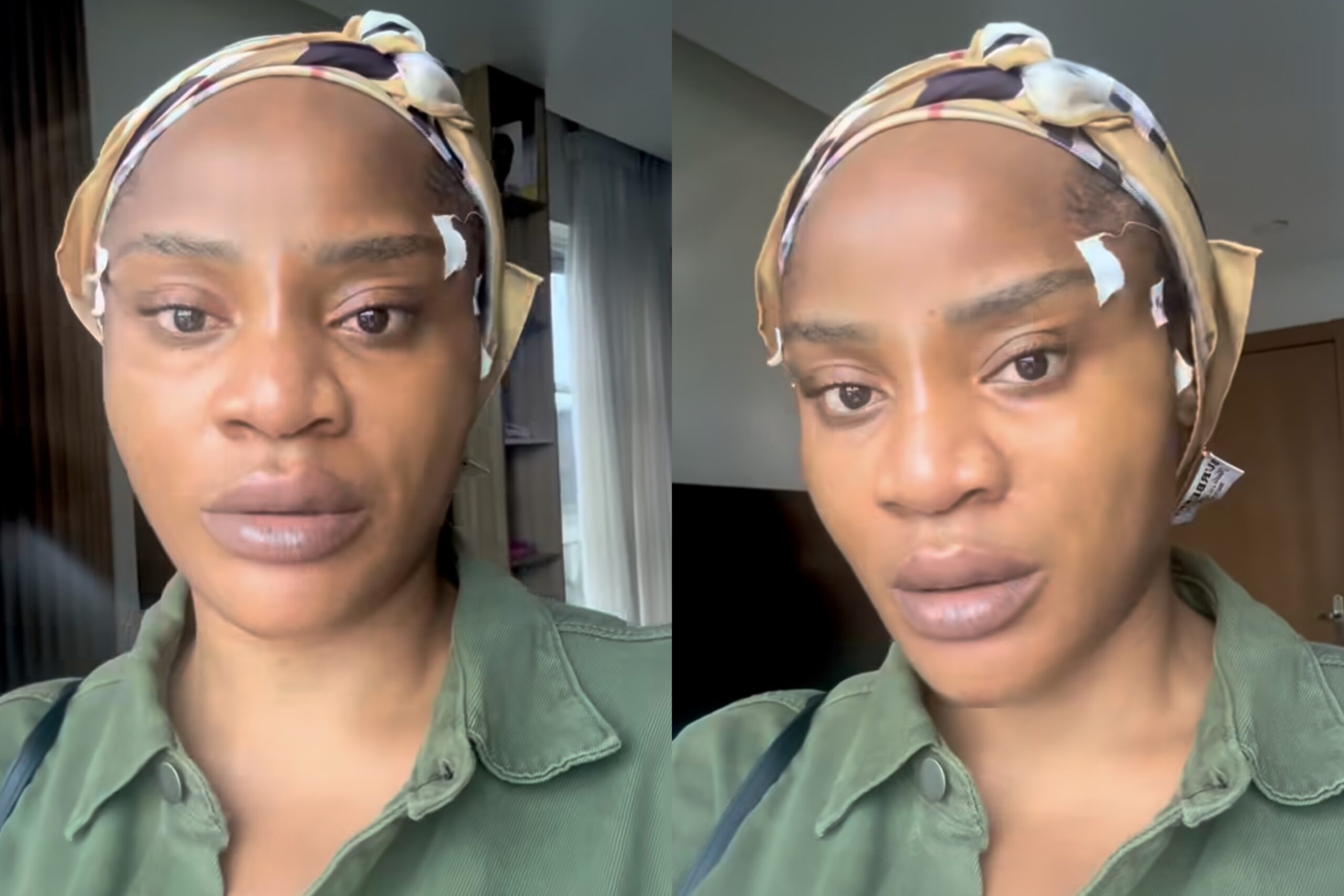 Uche Ogbodo Shares Day 1 Update After Facial Rejuvenation Procedure