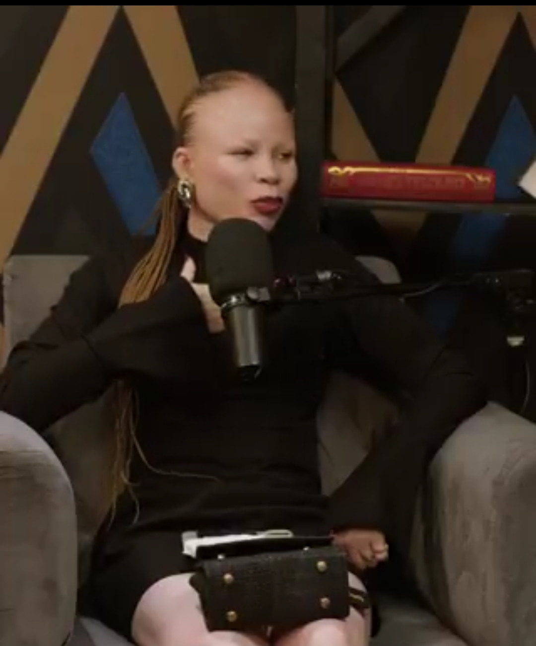 Nigerian Lady Recounts how She Lost Job Opportunities Due to Albinism